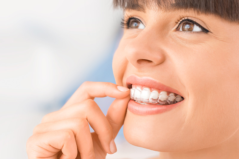 Clear Aligners Alamosa