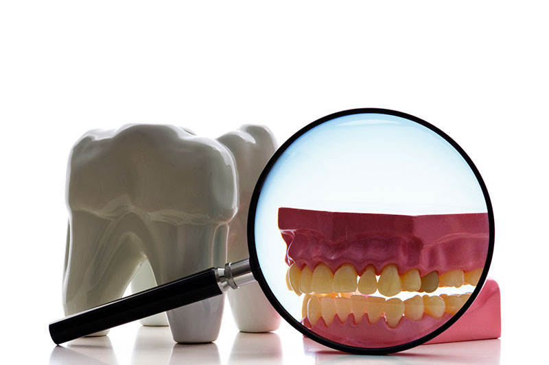 Root Canal in Alamosa